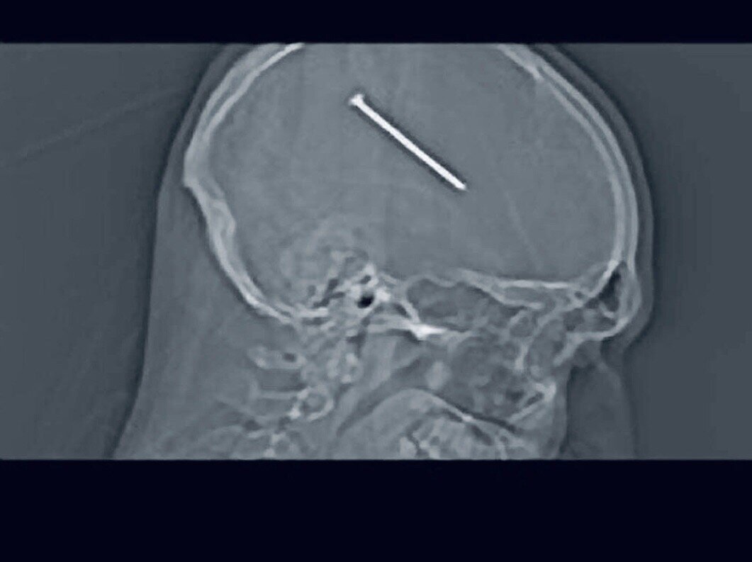 Источник: Яндекс. Картинки 