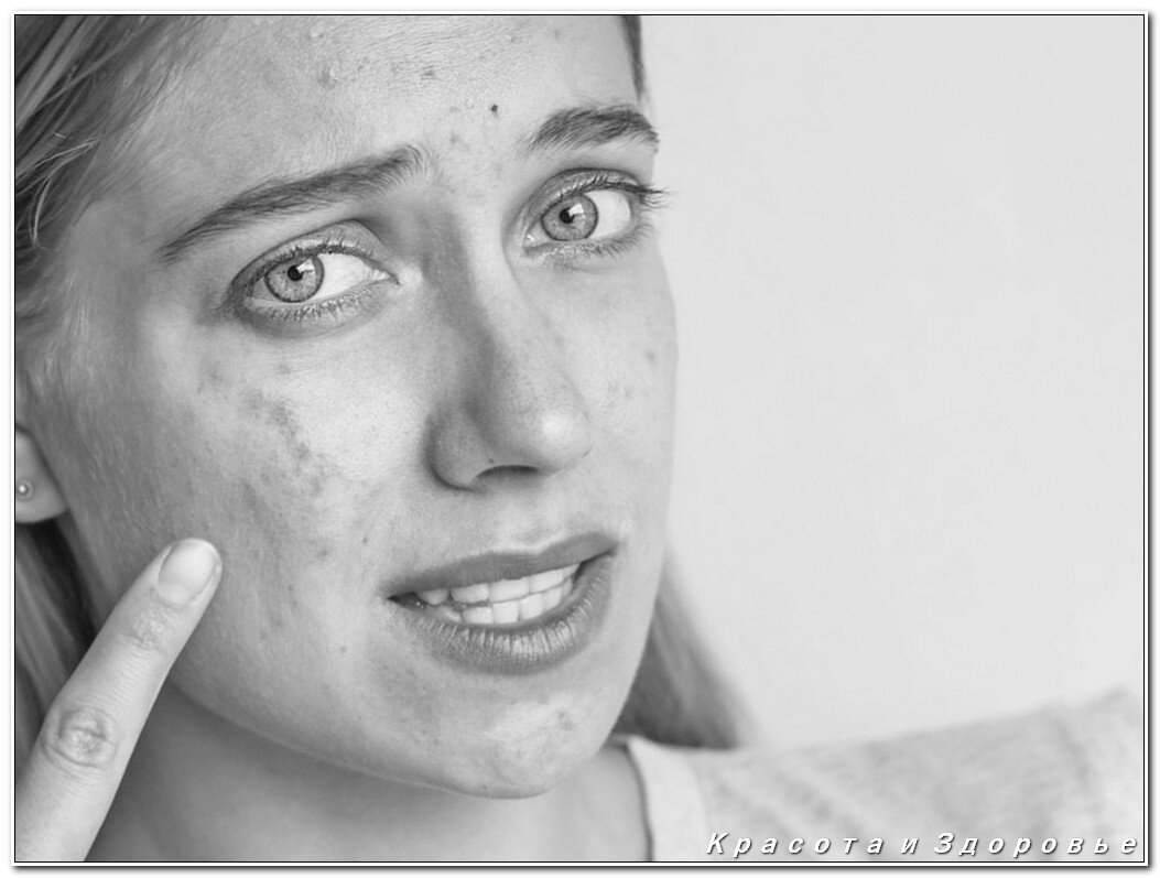 Источник фото: https://www.vasezdravlje.com