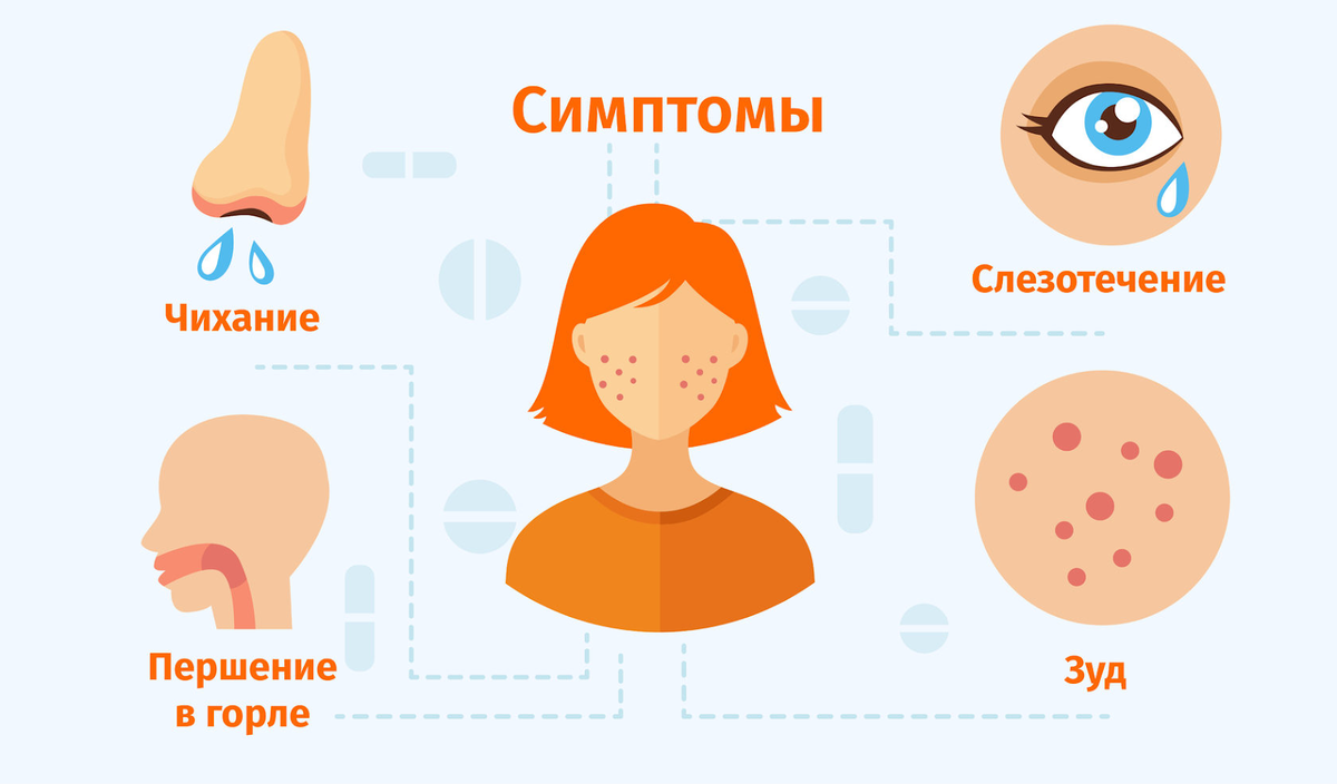 Першит горло слезятся глаза. Сенная лихорадка поллиноз симптомы.