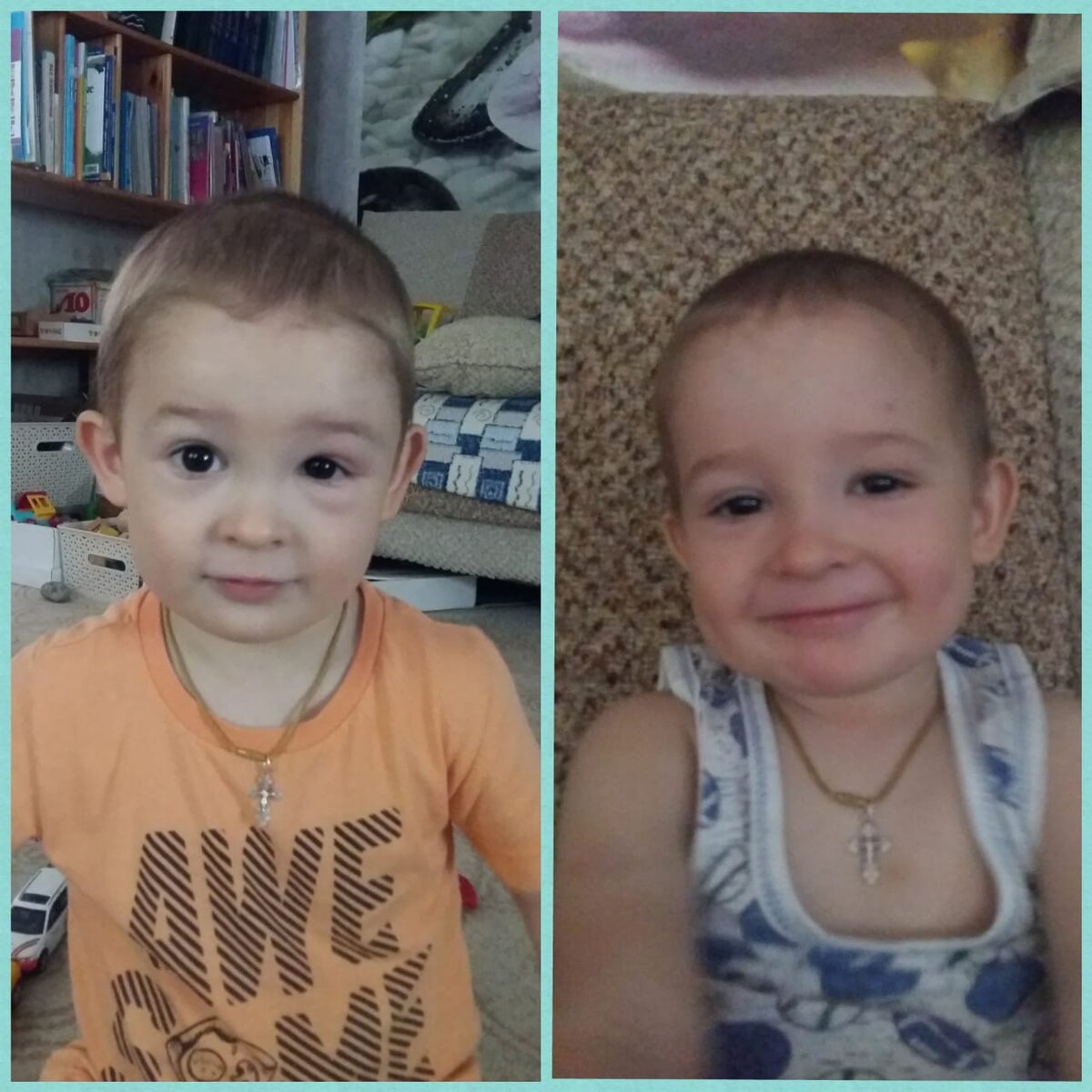 Фото слева – наутро после отпаивания ребенка по глотку каждые два часа препаратом, а справа – еще через сутки на этом же средстве, но уже гораздо реже глотки.