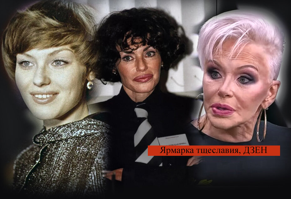 Ирина понаровская фото до и после пластики Как менялся стиль и внешний облик Ирины Понаровской Ярмарка тщеславия Дзен