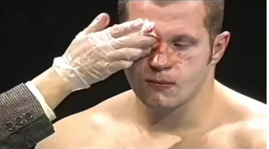 Федор Емельяненко, первое поражение. Фото с Яндекс картинок.