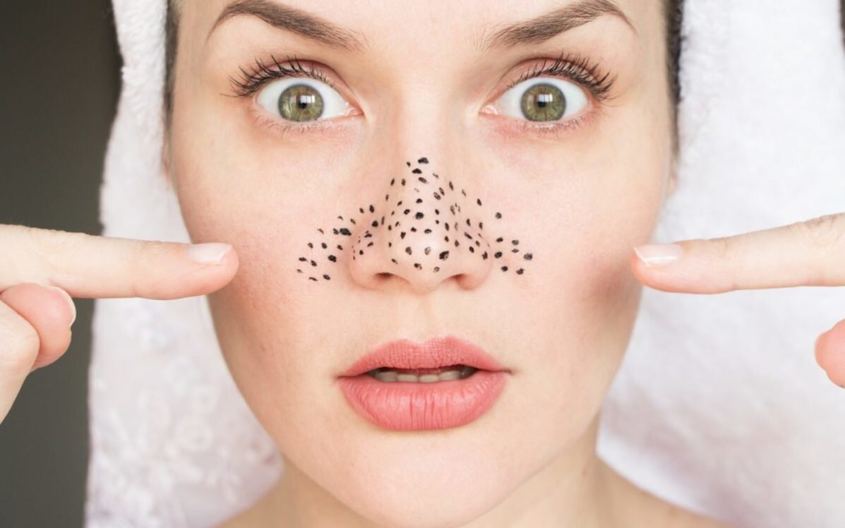 Как сделать кожу гладкой и чистой: 18 крутых лайфхаков от дерматолога | ЮниLook