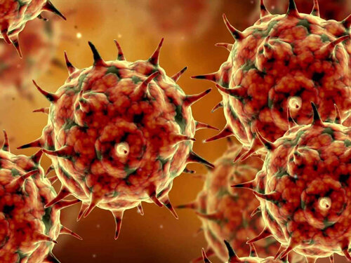 Опоясывающий герпес.