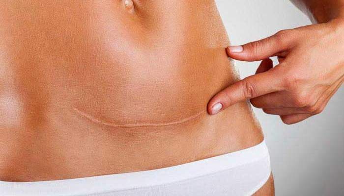 Хинт: началось все с этого.