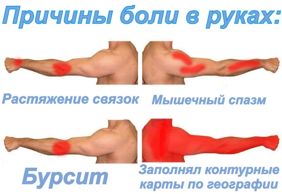 Теперь болит. Рука болит Мем. Карта боли на руке