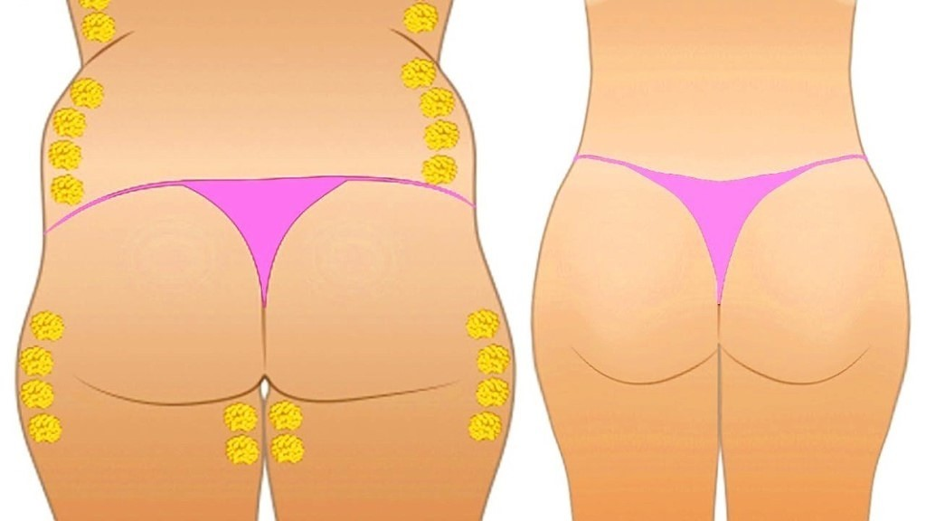 Данная диета подходит не всем дамам, проконсультируйтесь со специалистом!