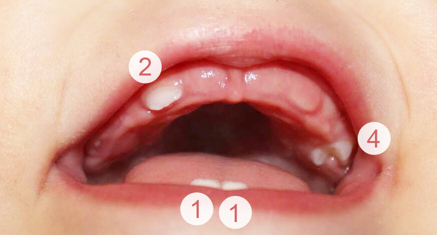 Когда должны прорезываться зубы у ребенка?