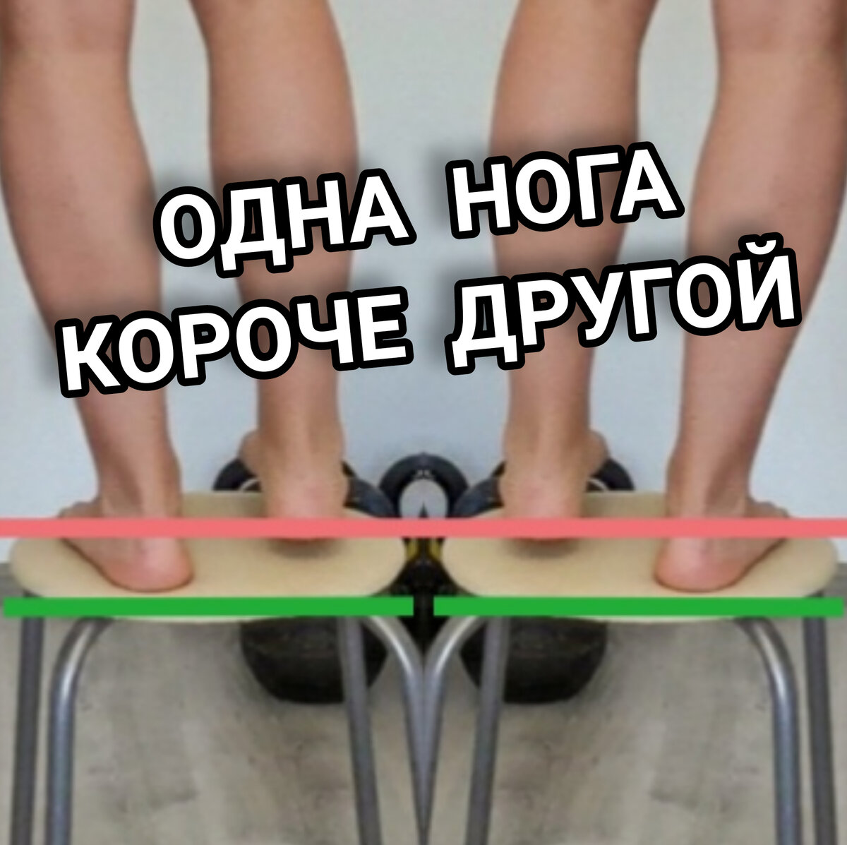 Ногу мало. Одна нога короче другой. Что делать если одна ножка короче другой.