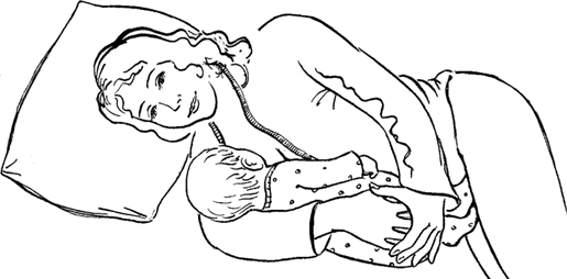 Кормление грудью «в положении на боку»