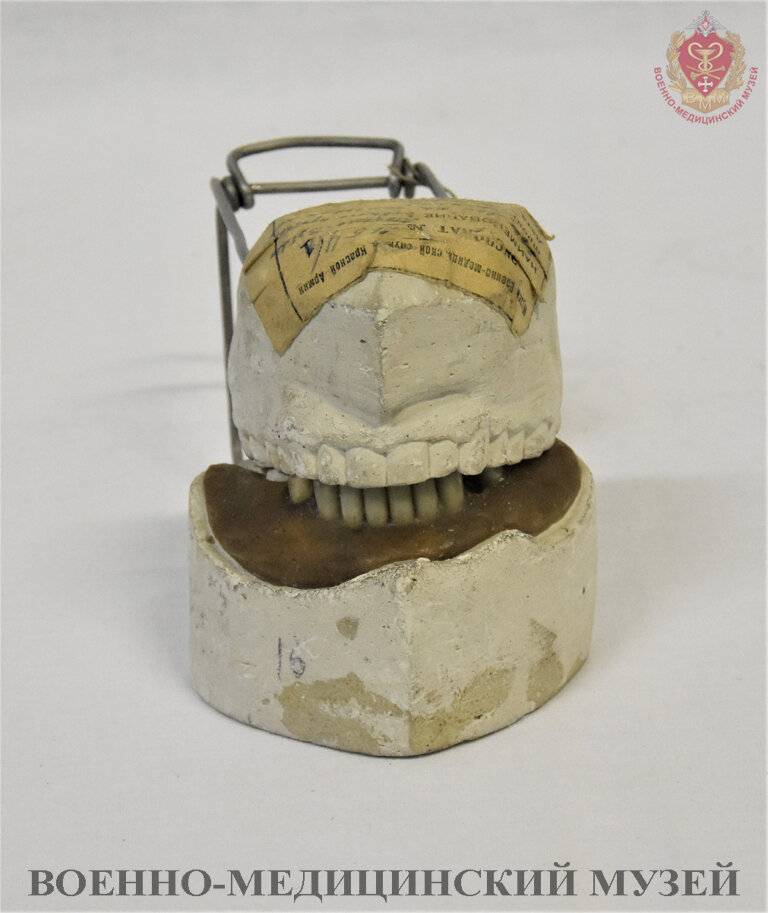 Шаблон зубного протеза, восковой. На гипсовых моделях челюстей. До 1943 г. Из коллекции Военно-медицинского музея.