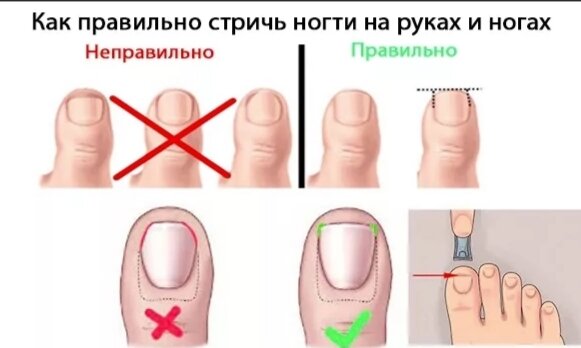 Полумесяцем или с уголками: как правильно стричь ногти?