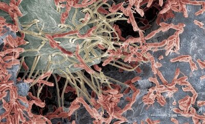 Сканирующая электронной микроскопия Rhodopseudomonas palustris (красная), колонизирующей поверхность электропроводящего графенового покрытия. Фото: University of Cambridge