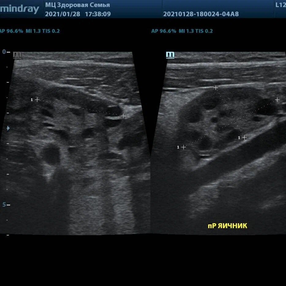  Константин Князев УЗИ / УЗД / ФД
