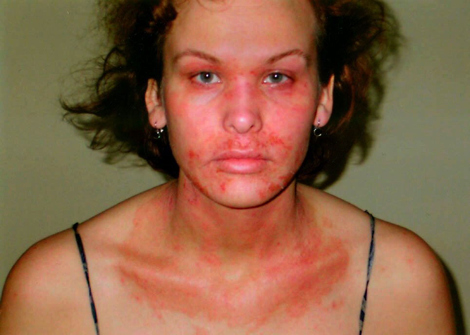 Фото использовано как иллюстрация, источник Яндекс картинки 