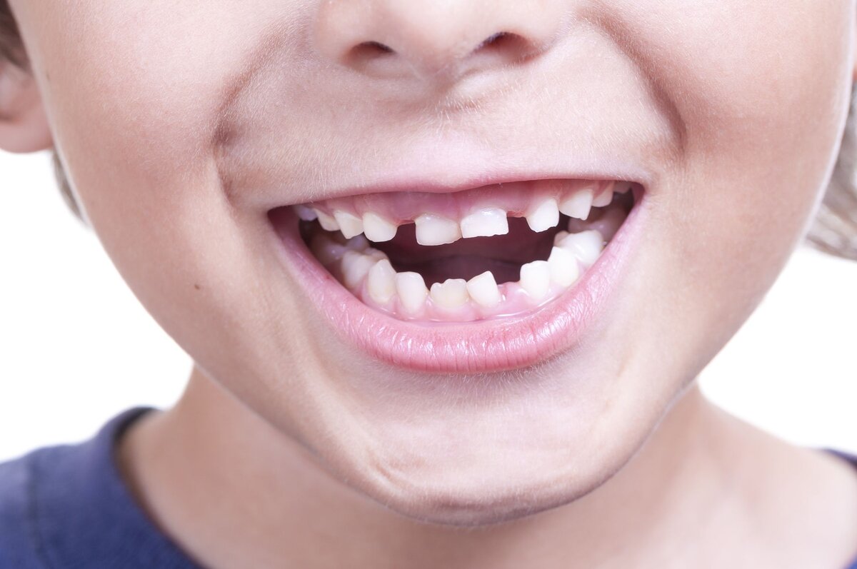 Какие возрастные ограничения есть у имплантации зубов и почему