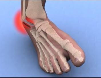 Изображение взято из поиска Яндекс