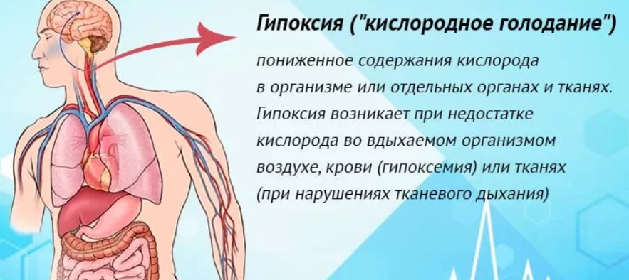                                                        источник сайт яндекс.картинки