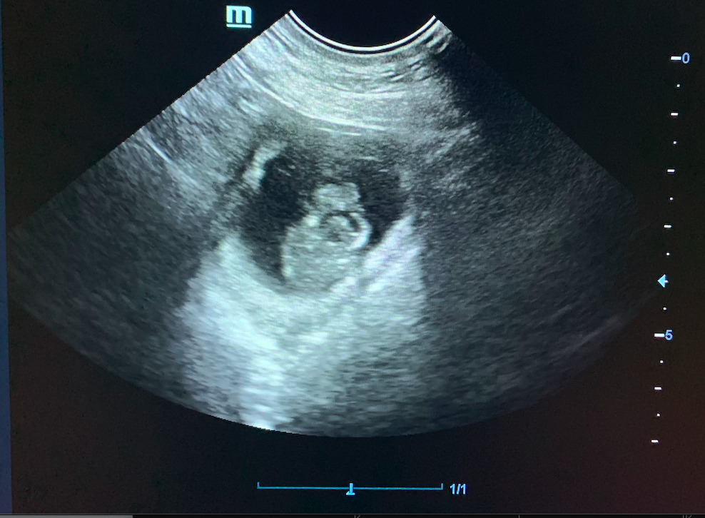 беременность на УЗИ. Кошка. Срок около 4 недель.