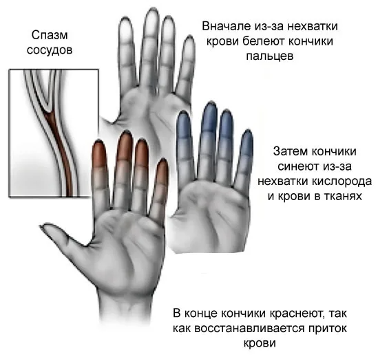 Кикути Кадзуко: инструктор по гимнастике продолжает дарить надежду и вдохновение в 90 лет