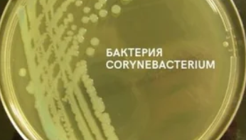 Виды бактерий, вызывающие бактериальные болезни картофеля, фото Яндекс.Картинки