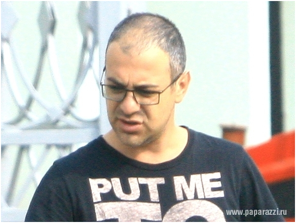 Мартиросян волосы до и после Garik Martirosyan against hair transplants: How he managed to defeat baldness! C