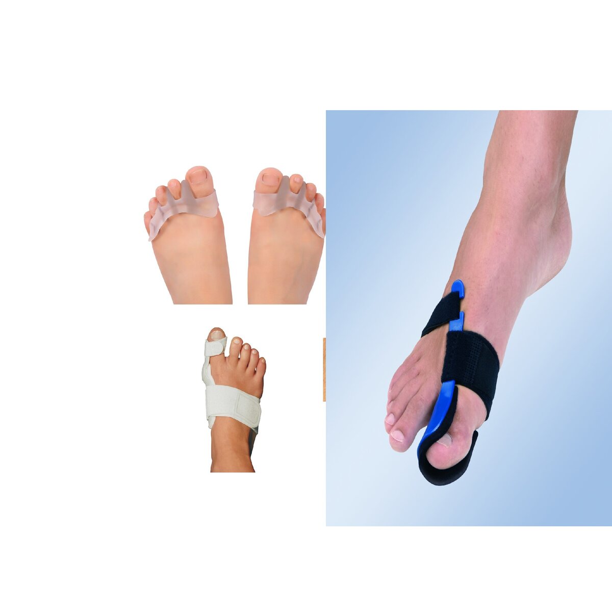 Различные виды бандажей и вкладышей при hallux valgus