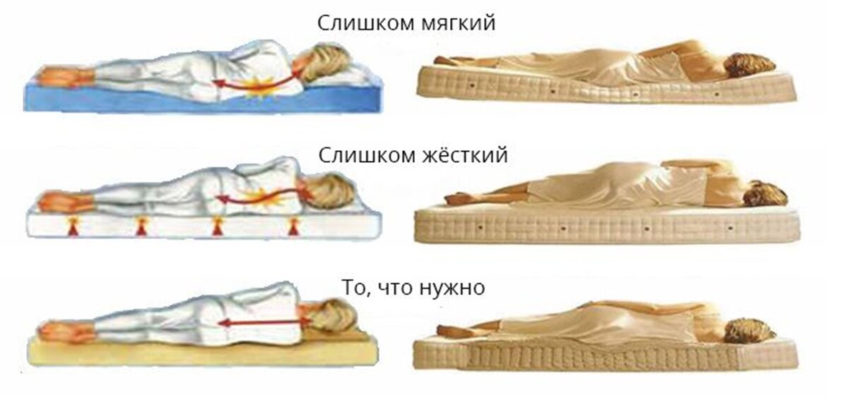                Правильное положение позвоночника показано на нижних рисунках