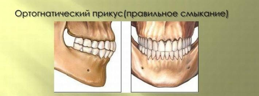 Правильный прикус зубов человека фото