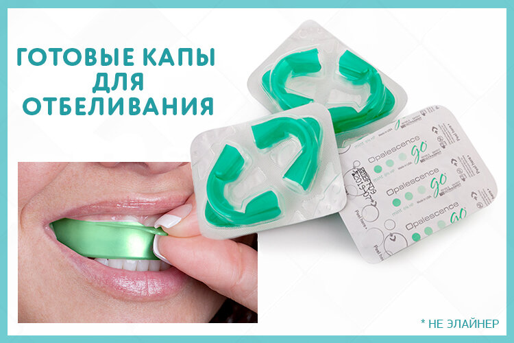 Капы и элайнеры – разные вещи или одно и то же? | Стоматология Smile-at ...