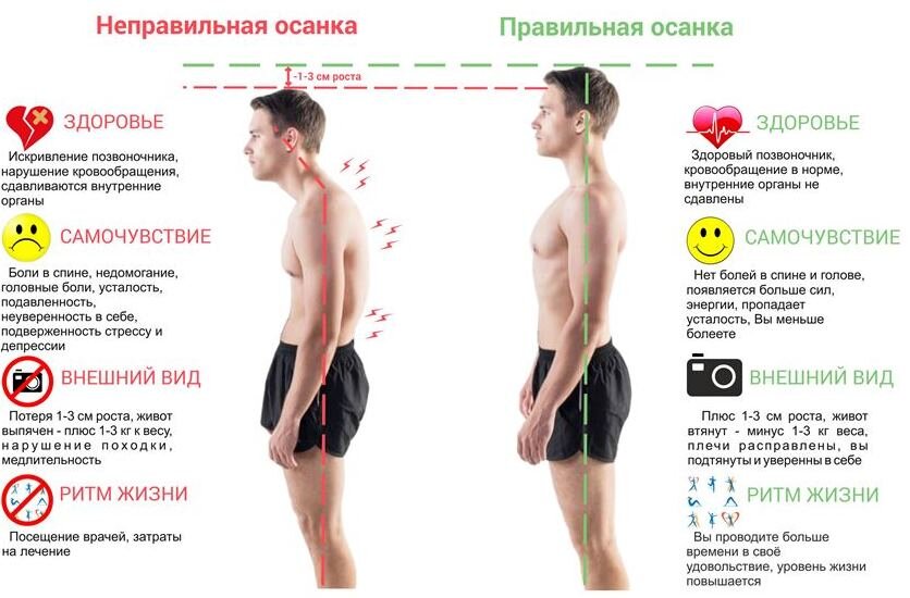 Влияние осанки на жизнедеятельность
