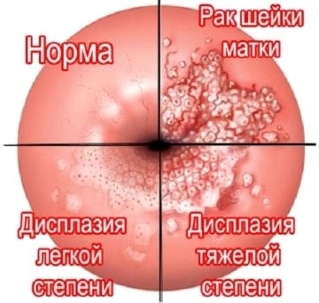 Показала строение влагалища - Смотреть секс, порно видео.