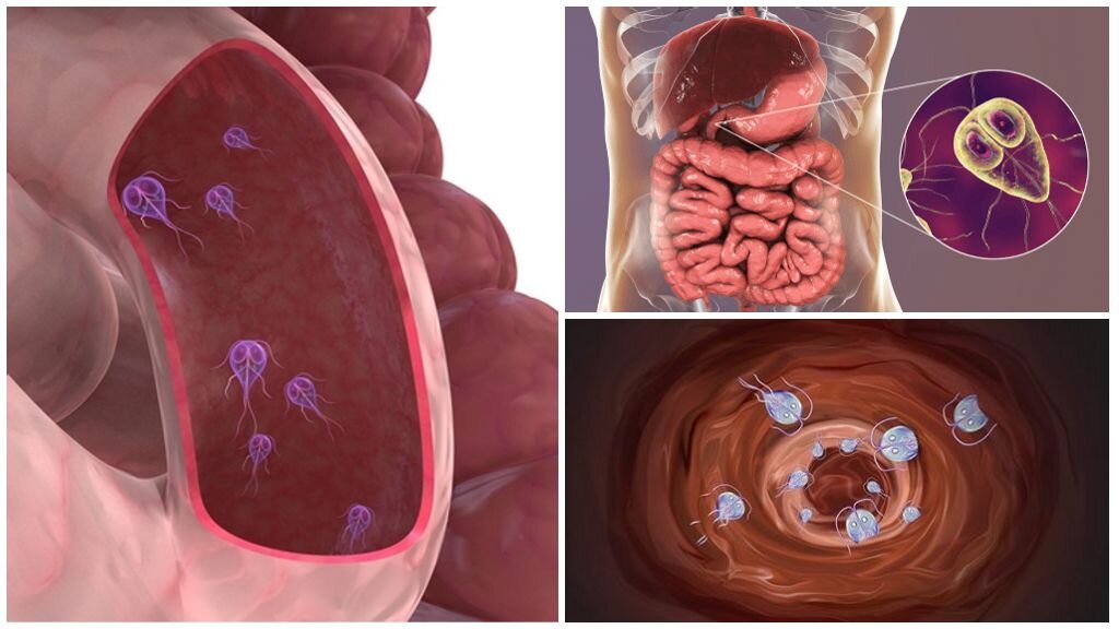 Препараты от лямблий