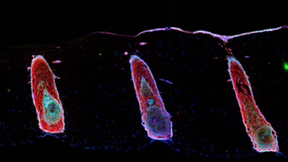 Волосяные фолликулы, выращенные на печатной платформе. Фото Angela Christiano / Columbia University Irving Medical Center.