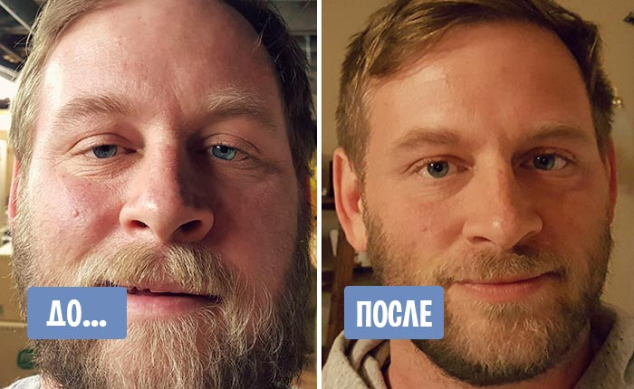 Лицо курильщика до и после отказа от курения фото