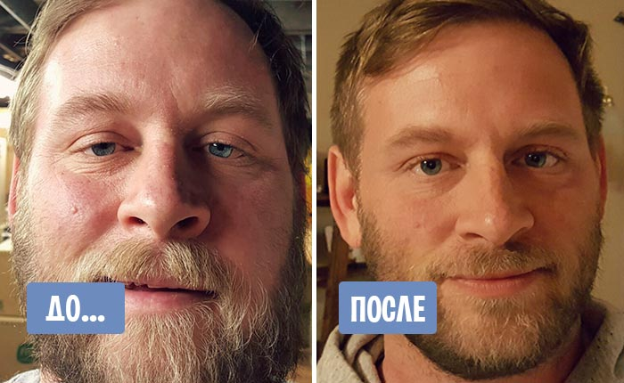 Через сколько перестанут. Лицо до и после отказа от алкоголя. Люди бросившие курить до и после. Лицо курильщика до и после отказа. Лицо после бросания курить до и после.