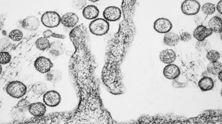 Хантавирус