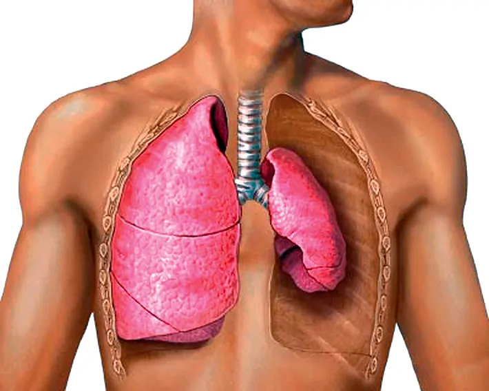 На рисунке изображено легкое уменьшенное в объеме  из-за повреждения  плевры.