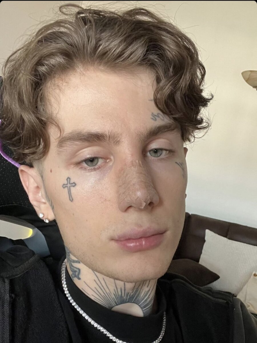 Как вы думаете инстасамка снова сделала операцию или это очередной хайп?¿