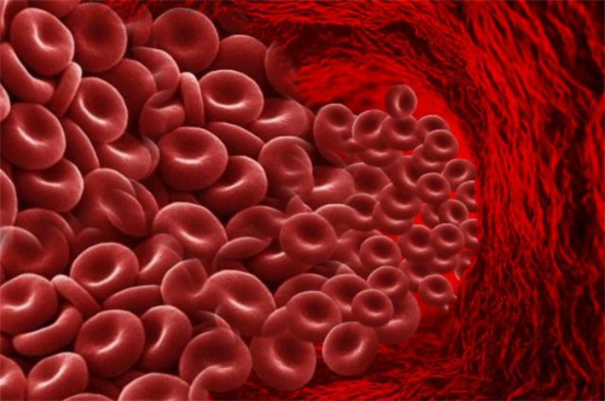 Густая кровь -  очень распространённая проблема на сегодняшний день в современном мире. Тромбоз и атеросклероз, такие последствия могут быть вызваны слишком повышенной густотой крови.