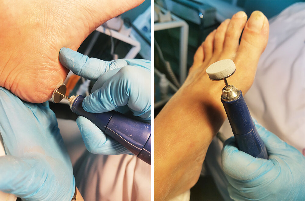 SMART-педикюр