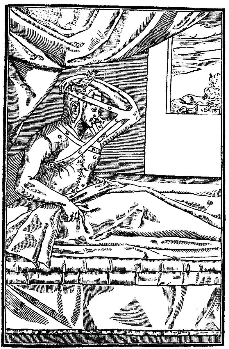 Картинка из трактата болонского хирурга Гаспара Тальякоцци, изданного в Венеции в 1597 году, который прославился благодаря виртуозному исполнению данной операции.