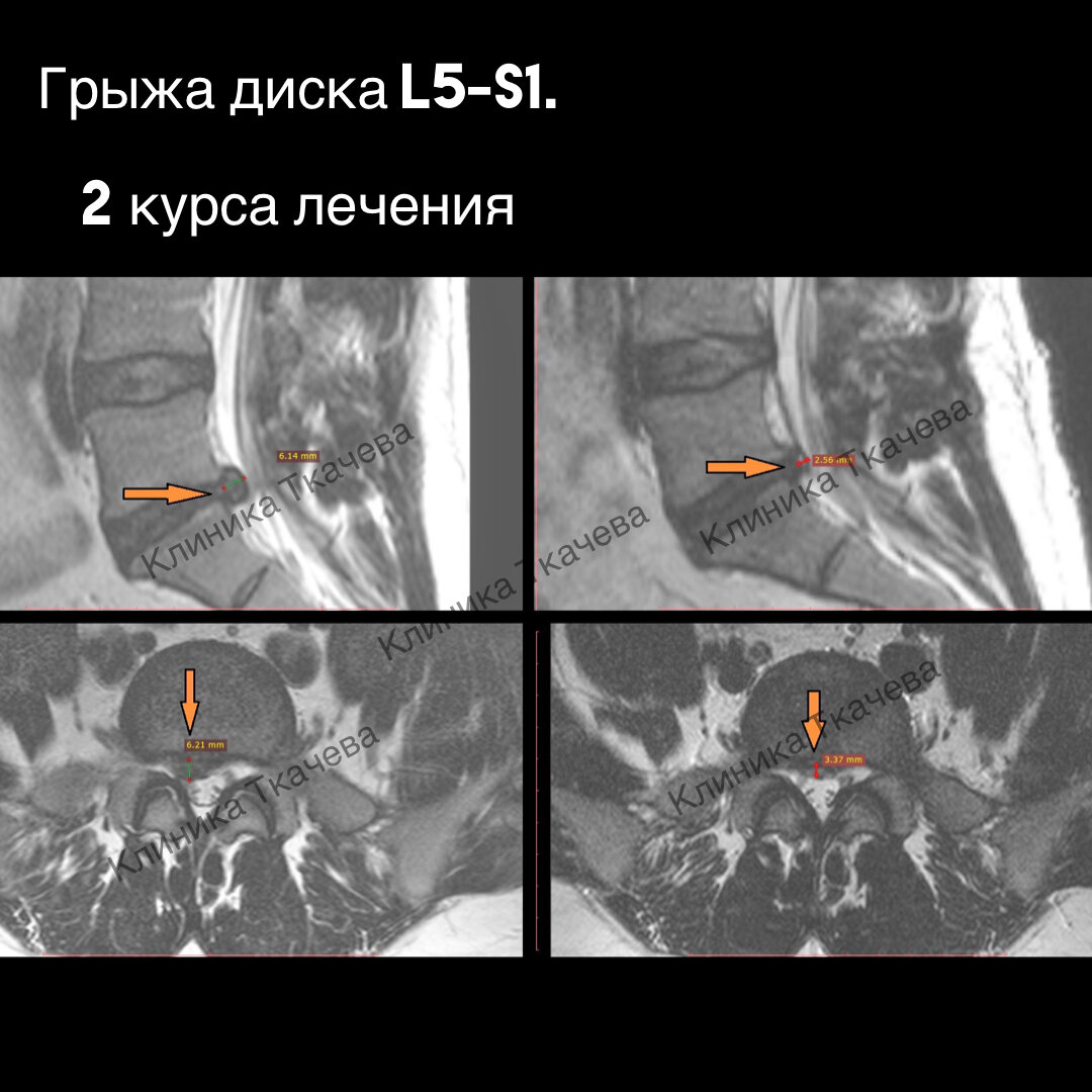 снимки опубликованы с разрешения пациента