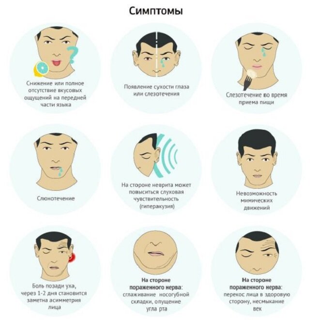 Новый вид операций: люди с параличом лица смогут закрывать глаза