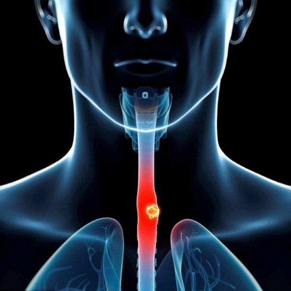 Фото с https://www.medikforum.ru/health/48925-nevozmozhnost-glotat-edva-ne-privela-k-smerti-ot-goloda.html