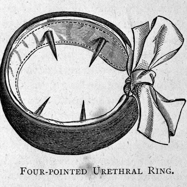 Четырехточечное уретральное кольцо для лечения мастурбации. Фото: CC BY / Wellcome Collection 