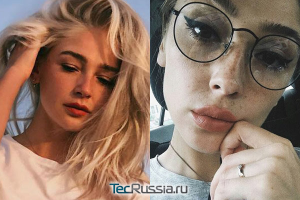 Ивлева до и после пластики фото
