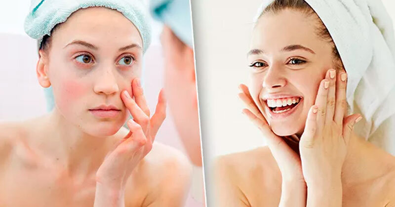 Как проснуться утром без отёков на лице?