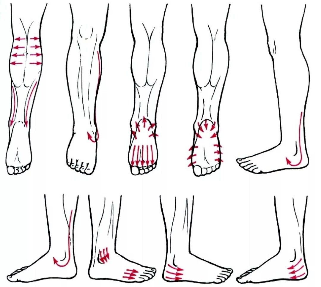 Массаж при нейропатии. Массаж при полинейропатии нижних конечностей техника. Массаж ног при нейропатии нижних конечностей. Схема лимфодренажного массажа ног. Массаж Гуаша для стопы схема.