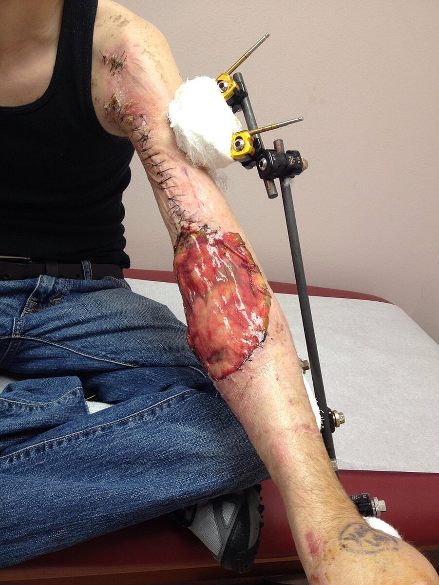 В больничной палате